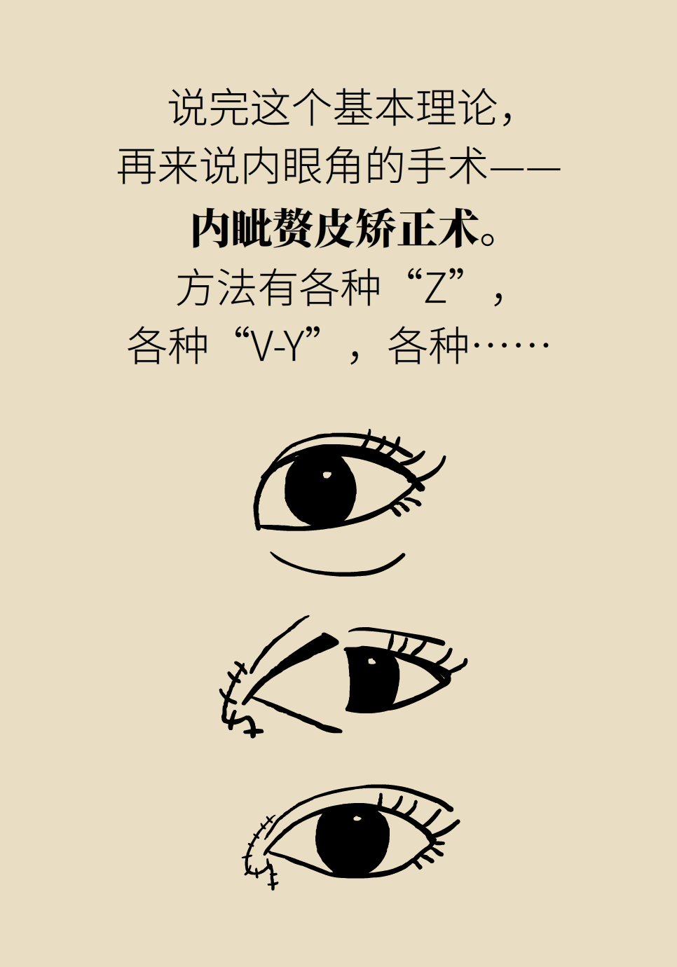 开眼角真的能让眼睛变大吗？关键要注意这一点842 / 作者:UFO爱好者 / 帖子ID:71529