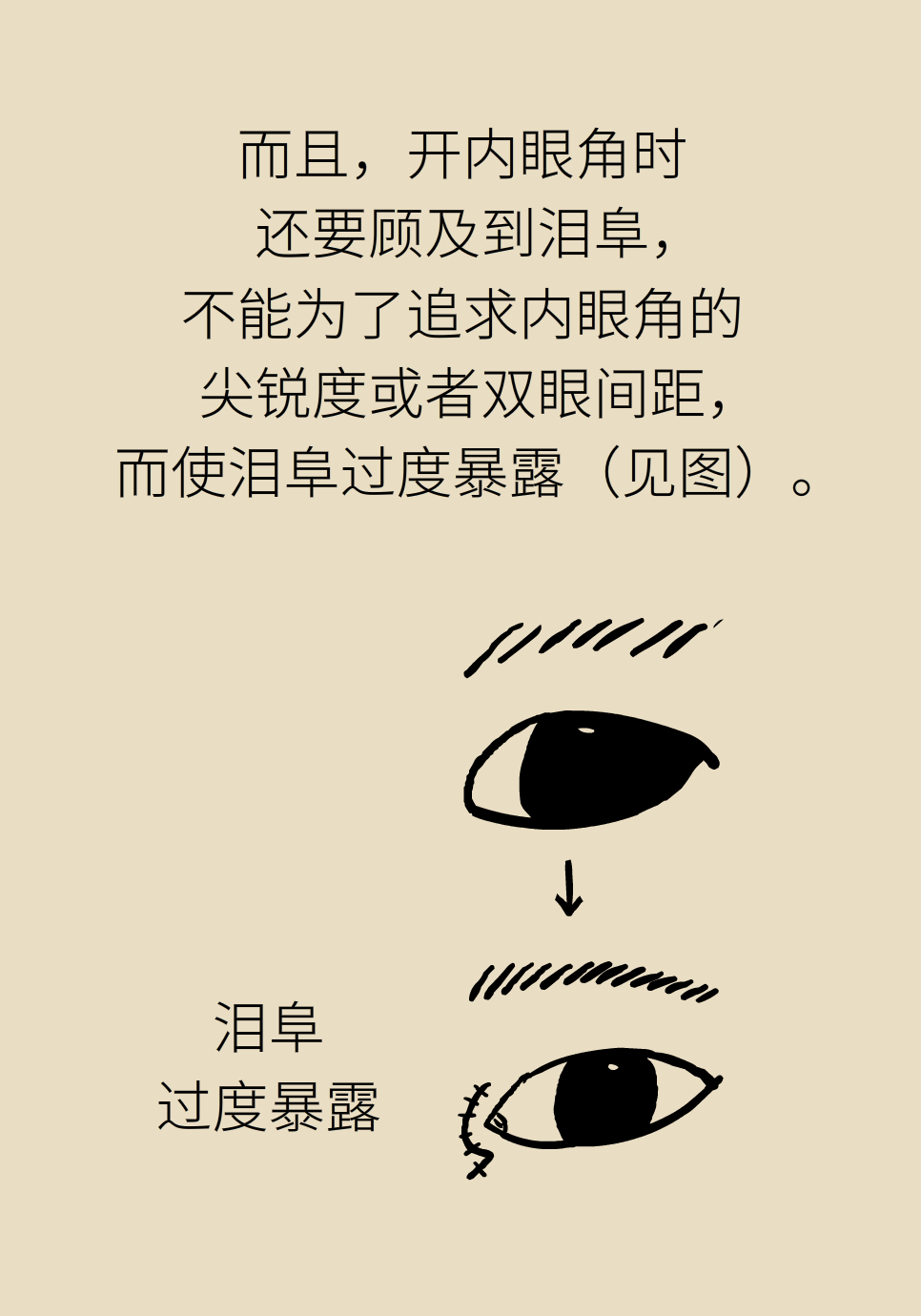 开眼角真的能让眼睛变大吗？关键要注意这一点888 / 作者:UFO爱好者 / 帖子ID:71529