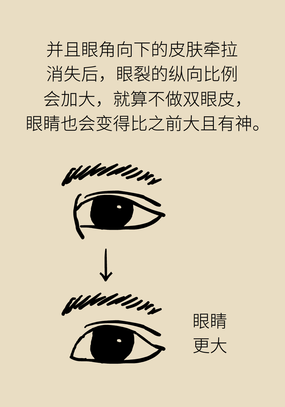 开眼角真的能让眼睛变大吗？关键要注意这一点931 / 作者:UFO爱好者 / 帖子ID:71529