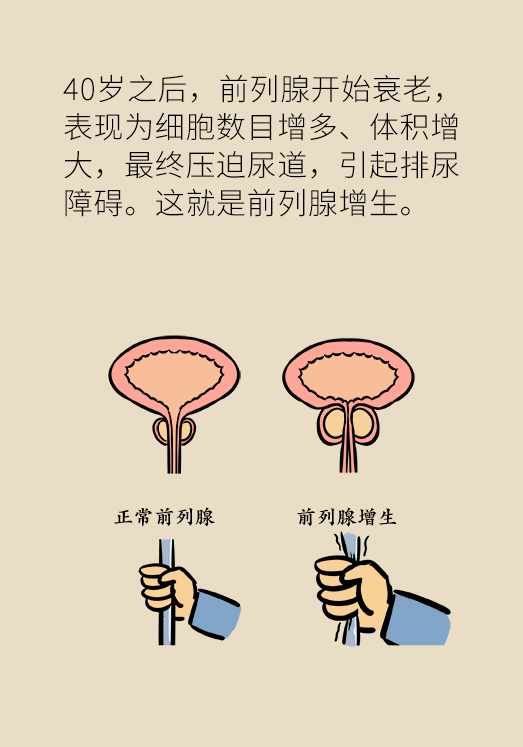 开会半小时跑两三次厕所？快来自测是否患有这个病699 / 作者:UFO爱好者 / 帖子ID:71861