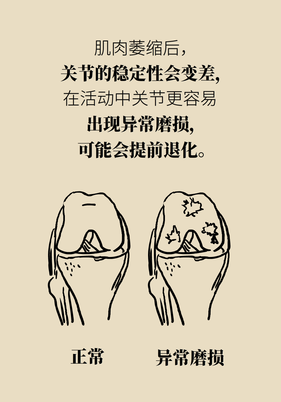 切断小腿肌肉神经可以瘦腿？你想太多了294 / 作者:UFO爱好者 / 帖子ID:71500