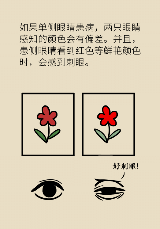 这种眼病常“叫板”中青年可致盲，警惕两症状98 / 作者:UFO爱好者 / 帖子ID:71472