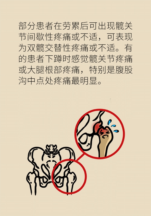 使用了激素股骨头会坏死吗？医生告诉你该怎么办175 / 作者:UFO爱好者 / 帖子ID:71322