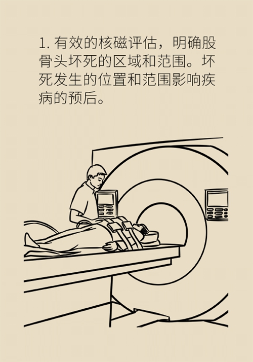 使用了激素股骨头会坏死吗？医生告诉你该怎么办89 / 作者:UFO爱好者 / 帖子ID:71322
