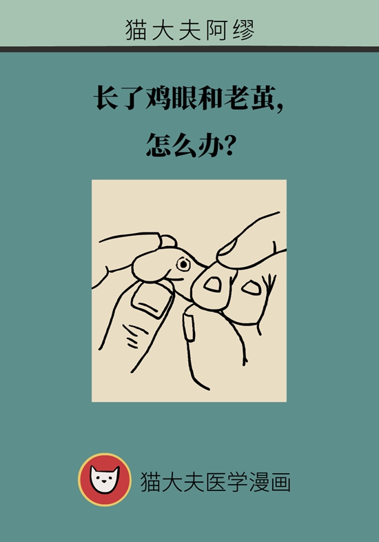 长了鸡眼和老茧怎么办？这份防治指南请收好923 / 作者:UFO爱好者 / 帖子ID:71145