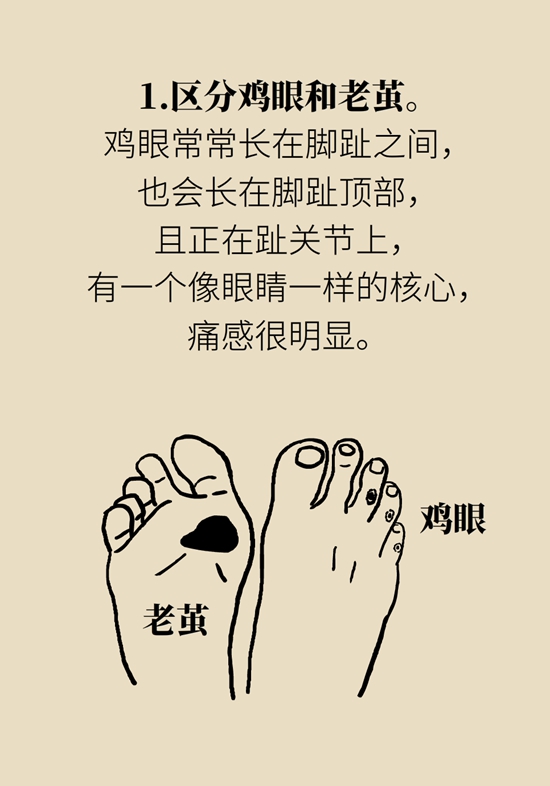 长了鸡眼和老茧怎么办？这份防治指南请收好370 / 作者:UFO爱好者 / 帖子ID:71145