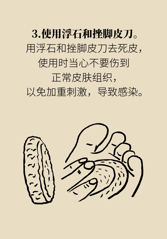 长了鸡眼和老茧怎么办？这份防治指南请收好942 / 作者:UFO爱好者 / 帖子ID:71145