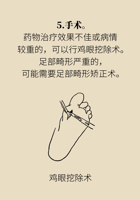 长了鸡眼和老茧怎么办？这份防治指南请收好918 / 作者:UFO爱好者 / 帖子ID:71145