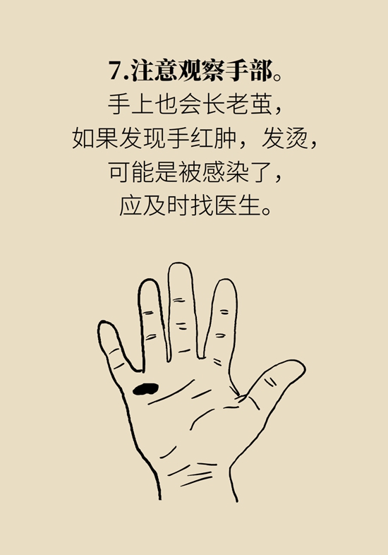 长了鸡眼和老茧怎么办？这份防治指南请收好960 / 作者:UFO爱好者 / 帖子ID:71145