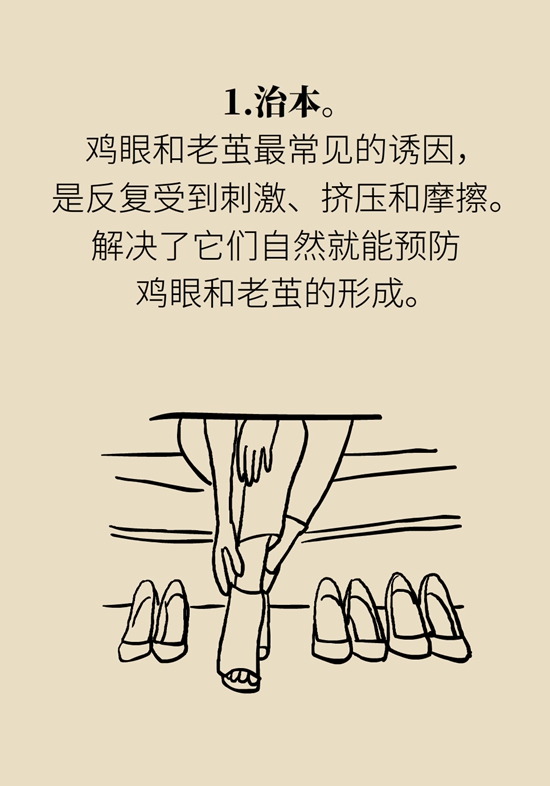 长了鸡眼和老茧怎么办？这份防治指南请收好366 / 作者:UFO爱好者 / 帖子ID:71145