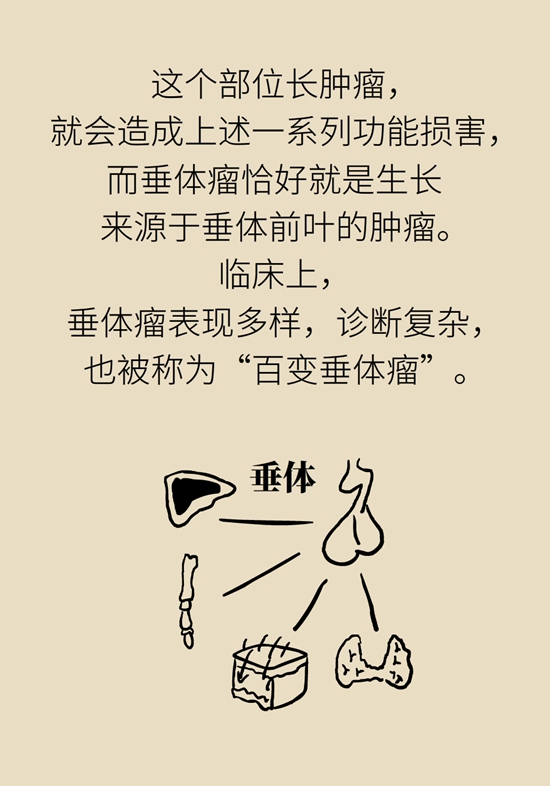 变丑、变胖、内分泌失调……这些糟心事警惕脑肿瘤624 / 作者:UFO爱好者 / 帖子ID:70967