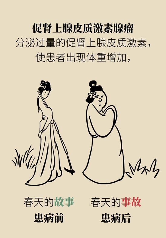 变丑、变胖、内分泌失调……这些糟心事警惕脑肿瘤934 / 作者:UFO爱好者 / 帖子ID:70967