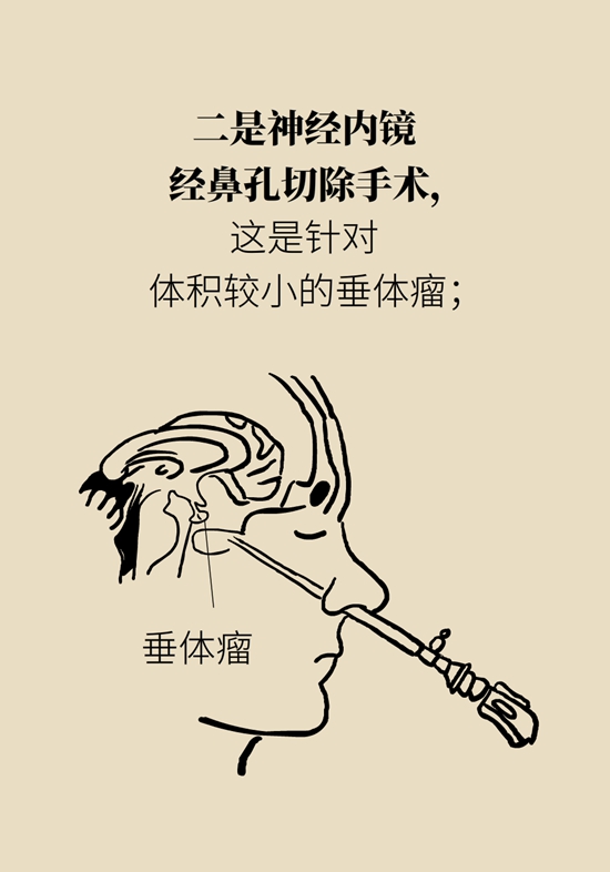 变丑、变胖、内分泌失调……这些糟心事警惕脑肿瘤981 / 作者:UFO爱好者 / 帖子ID:70967