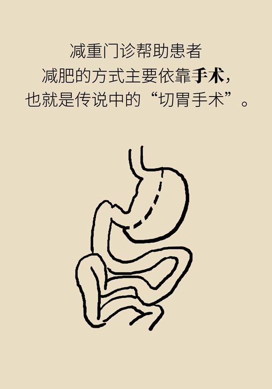 哪些人能做减重手术？医生：符合这个指标才行928 / 作者:UFO爱好者 / 帖子ID:70755