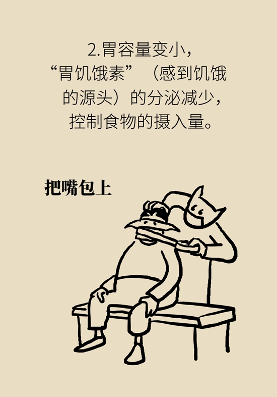 哪些人能做减重手术？医生：符合这个指标才行28 / 作者:UFO爱好者 / 帖子ID:70755