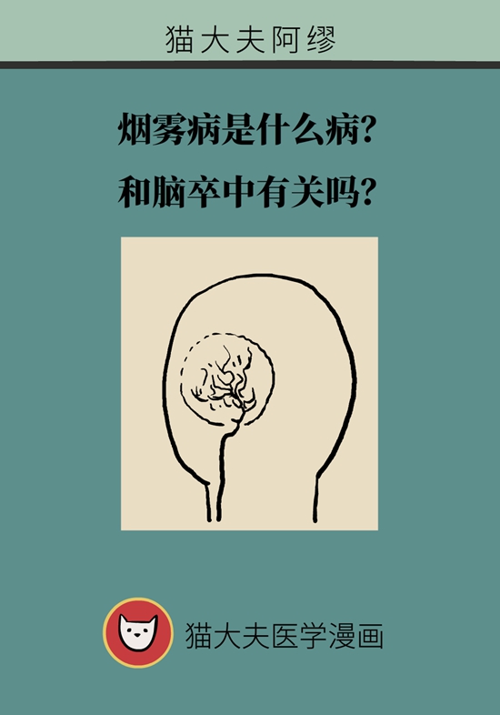 烟雾病是什么病？和脑卒中有关？解密大脑中的“烟雾”513 / 作者:UFO爱好者 / 帖子ID:70574