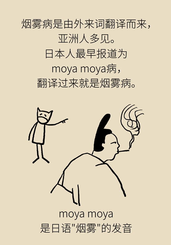烟雾病是什么病？和脑卒中有关？解密大脑中的“烟雾”208 / 作者:UFO爱好者 / 帖子ID:70574