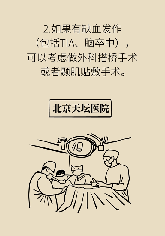 烟雾病是什么病？和脑卒中有关？解密大脑中的“烟雾”673 / 作者:UFO爱好者 / 帖子ID:70574