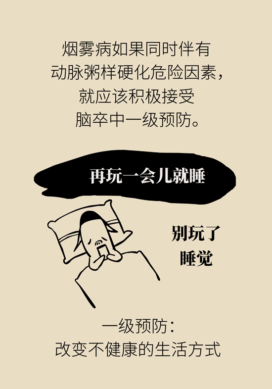 烟雾病是什么病？和脑卒中有关？解密大脑中的“烟雾”571 / 作者:UFO爱好者 / 帖子ID:70574