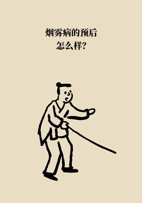 烟雾病是什么病？和脑卒中有关？解密大脑中的“烟雾”438 / 作者:UFO爱好者 / 帖子ID:70574