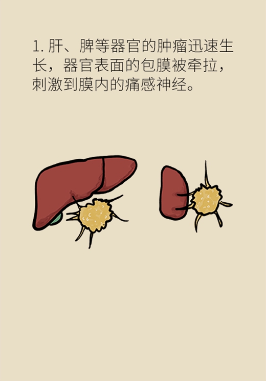 怎样的疼痛会是癌症？有了这种痛千万别忍着890 / 作者:UFO爱好者 / 帖子ID:70337