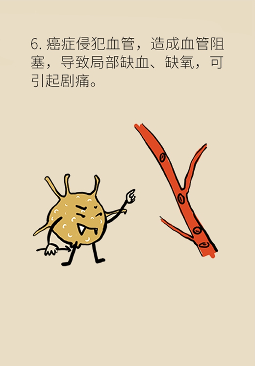 怎样的疼痛会是癌症？有了这种痛千万别忍着326 / 作者:UFO爱好者 / 帖子ID:70337
