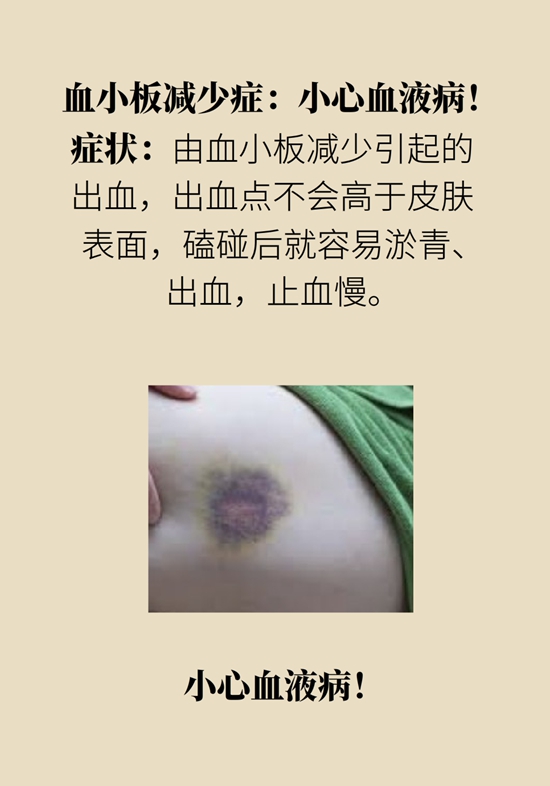 身上出现红斑、红点别不当回事，警惕癌变97 / 作者:UFO爱好者 / 帖子ID:70329