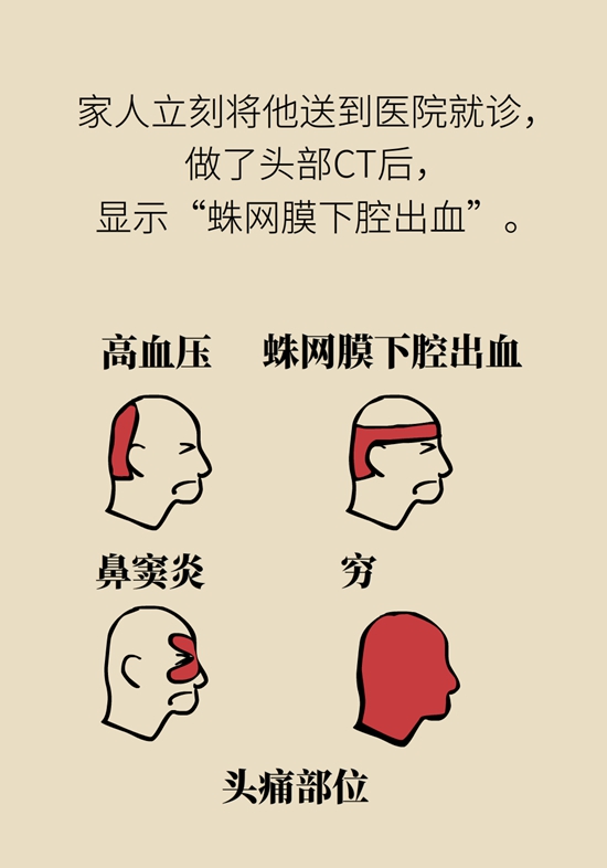 蛛网膜下腔出血是脑卒中吗？5大病因要提前了解228 / 作者:UFO爱好者 / 帖子ID:70317