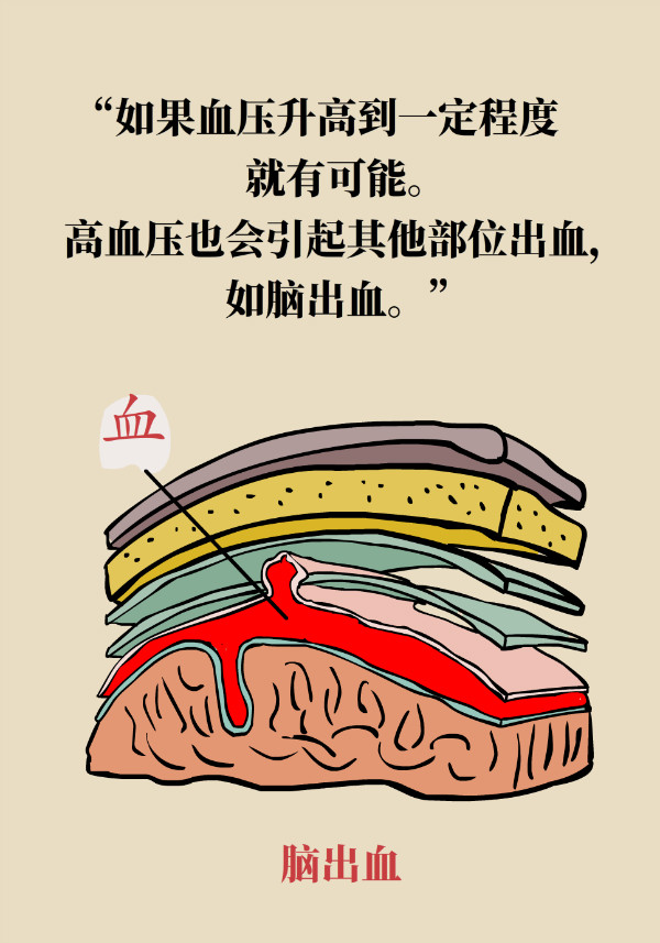 鼻子突然出血别大意！当心患上这种病146 / 作者:UFO爱好者 / 帖子ID:70129