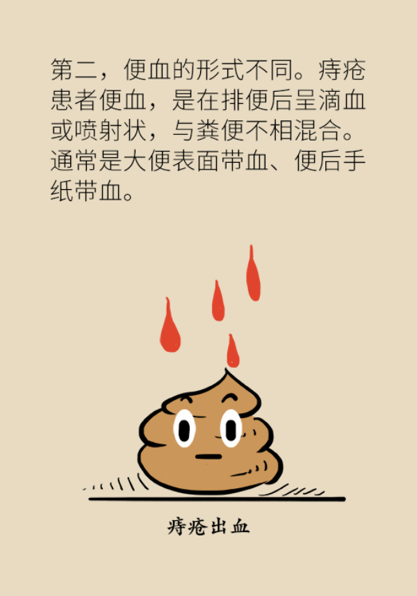 便血查出直肠癌？三招教你辨别是痔疮还是癌342 / 作者:UFO爱好者 / 帖子ID:70127