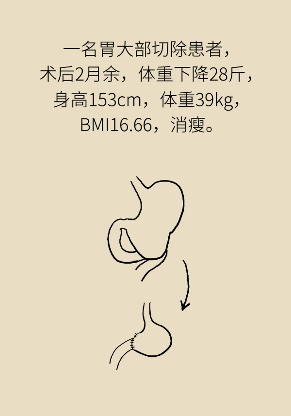 40%以上成年人需减重，但这几类人群必须要增重358 / 作者:UFO爱好者 / 帖子ID:69907