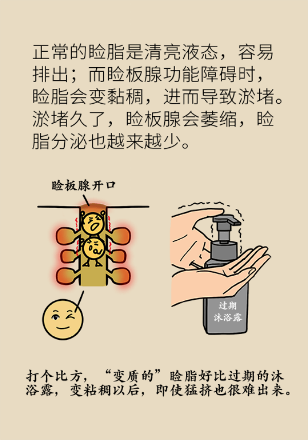 眼睛里比进沙子还痛！“四步专业眨眼法”赶紧学起来386 / 作者:UFO爱好者 / 帖子ID:69903