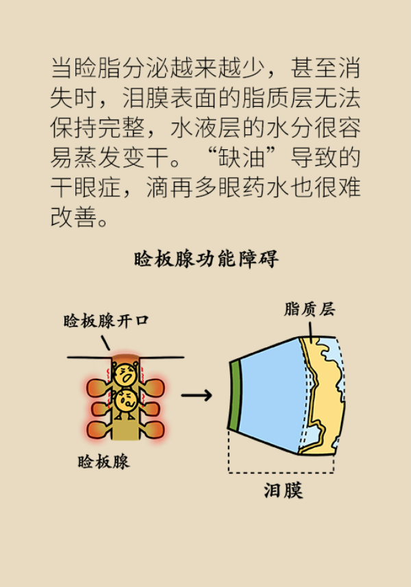眼睛里比进沙子还痛！“四步专业眨眼法”赶紧学起来463 / 作者:UFO爱好者 / 帖子ID:69903