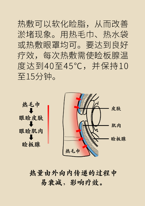 眼睛里比进沙子还痛！“四步专业眨眼法”赶紧学起来469 / 作者:UFO爱好者 / 帖子ID:69903