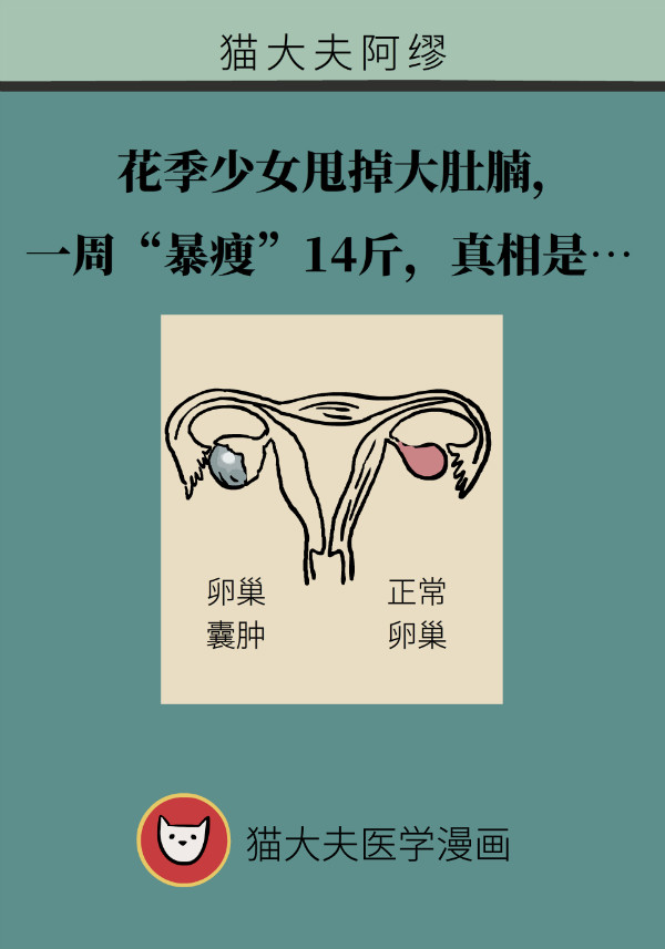 腰围莫名增粗别大意，你可能得了这种妇科疾病45 / 作者:UFO爱好者 / 帖子ID:69898