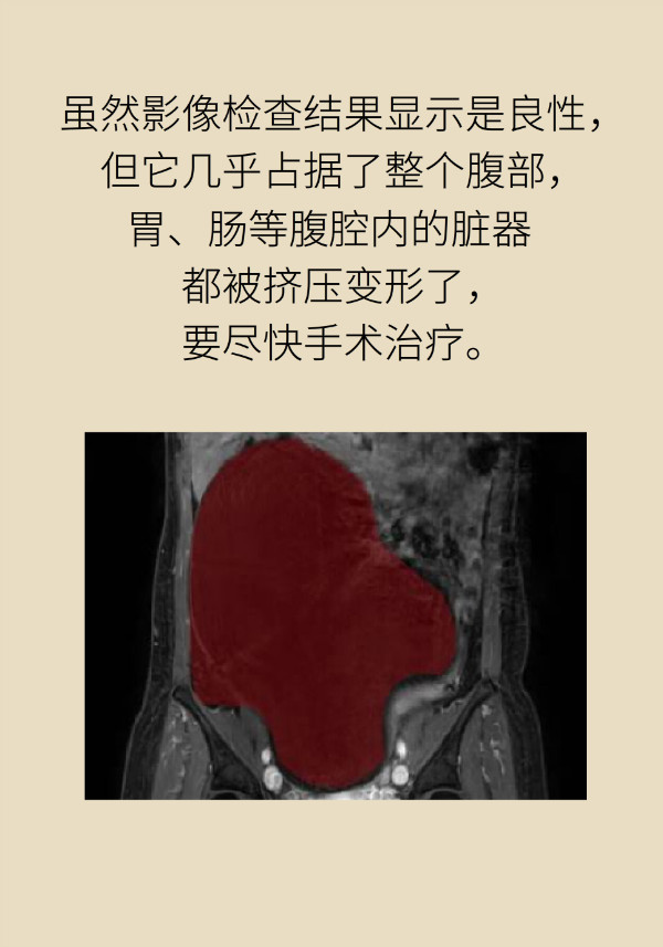 腰围莫名增粗别大意，你可能得了这种妇科疾病470 / 作者:UFO爱好者 / 帖子ID:69898
