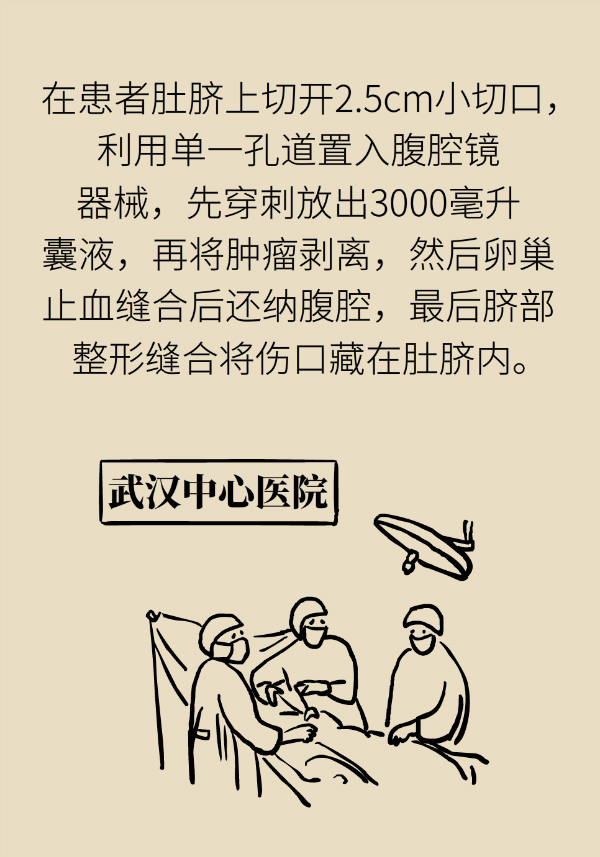 腰围莫名增粗别大意，你可能得了这种妇科疾病262 / 作者:UFO爱好者 / 帖子ID:69898