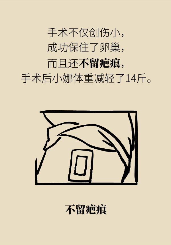 腰围莫名增粗别大意，你可能得了这种妇科疾病534 / 作者:UFO爱好者 / 帖子ID:69898