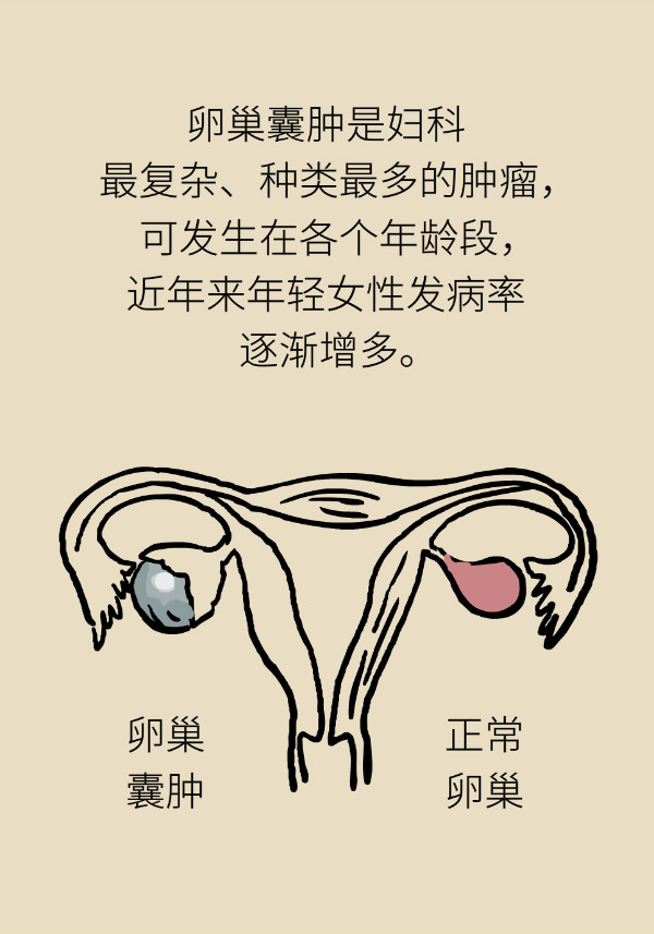 腰围莫名增粗别大意，你可能得了这种妇科疾病442 / 作者:UFO爱好者 / 帖子ID:69898