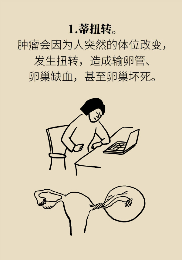 腰围莫名增粗别大意，你可能得了这种妇科疾病625 / 作者:UFO爱好者 / 帖子ID:69898