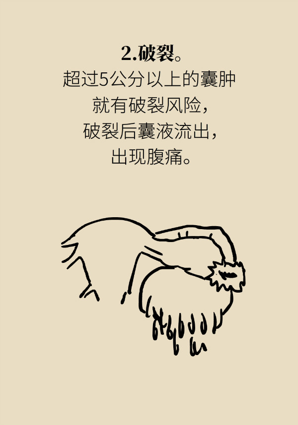 腰围莫名增粗别大意，你可能得了这种妇科疾病749 / 作者:UFO爱好者 / 帖子ID:69898