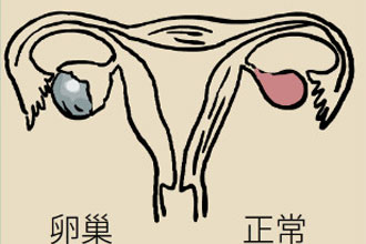 腰围莫名增粗别大意，你可能得了这种妇科疾病90 / 作者:UFO爱好者 / 帖子ID:69898