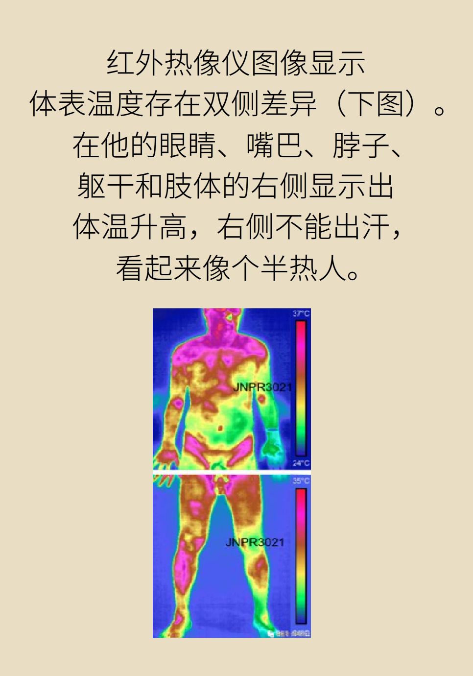 对待身体的这个部位要“温柔”，乱碰可能会丧命！634 / 作者:UFO爱好者 / 帖子ID:69869