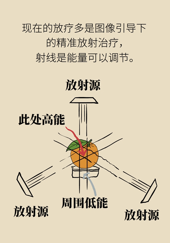 一半以上的肿瘤需要放疗，害怕辐射不如了解一下202 / 作者:UFO爱好者 / 帖子ID:69219