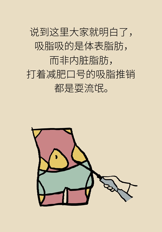 吸脂手术咋吸的？吸得越多越好？遵循四原则653 / 作者:UFO爱好者 / 帖子ID:69201