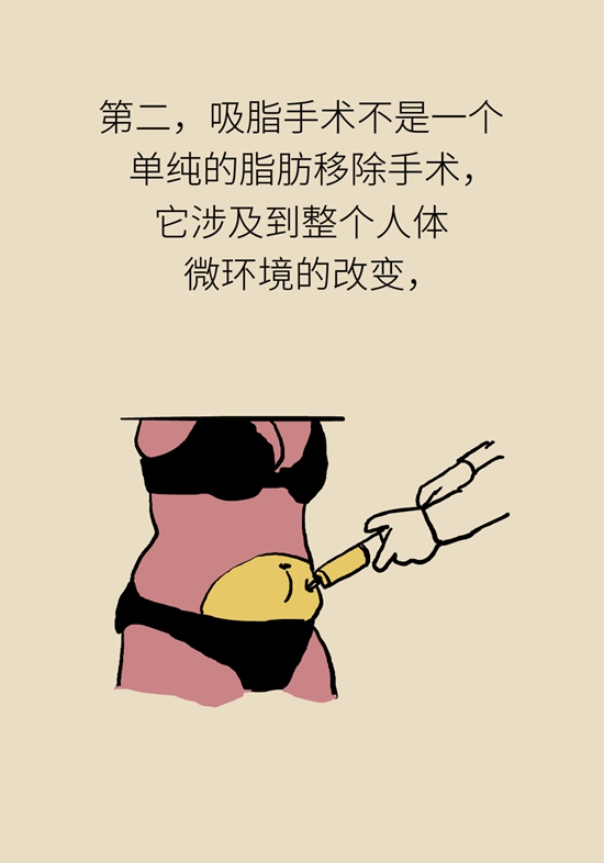 吸脂手术咋吸的？吸得越多越好？遵循四原则139 / 作者:UFO爱好者 / 帖子ID:69201