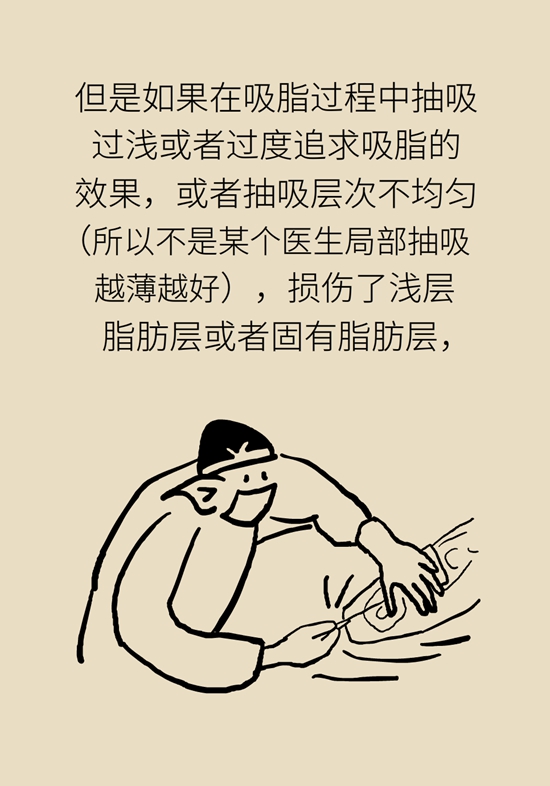吸脂手术咋吸的？吸得越多越好？遵循四原则820 / 作者:UFO爱好者 / 帖子ID:69201