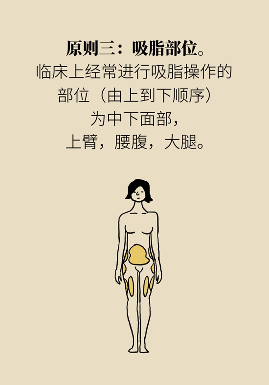 吸脂手术咋吸的？吸得越多越好？遵循四原则549 / 作者:UFO爱好者 / 帖子ID:69201