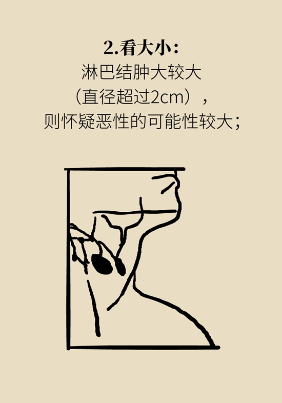 淋巴结肿大预示着哪些疾病？这样“摸”可自查551 / 作者:UFO爱好者 / 帖子ID:69211