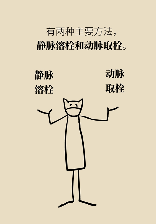 脑血管堵塞还能通吗？了解一下再灌注治疗138 / 作者:UFO爱好者 / 帖子ID:68972